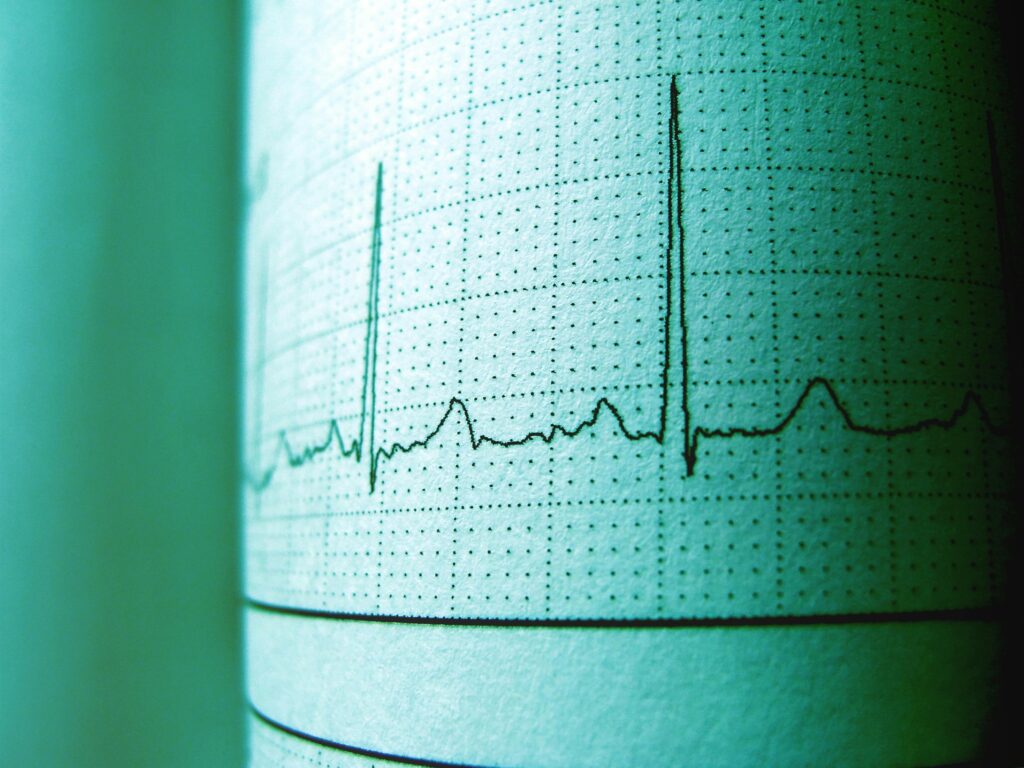 Reklama pulsacyjna – jak zwiększyć skuteczność kampanii dzięki zmianie intensywności? Reklama pulsacyjna – wykres EKG z wyraźnymi impulsami jako symbol cyklicznych działań reklamowych i okresowego zwiększania intensywności kampanii marketingowej